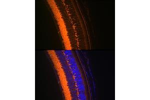 Immunofluorescence analysis of mouse eye using V Rabbit mAb (ABIN7271313) at dilution of 1:100 (40x lens). (VAMP2 antibody)