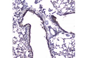 IHC testing of FFPE mouse lung tissue with PDE4D antibody. (PDE4D antibody)