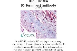 Image no. 1 for anti-Upper Zone of Growth Plate and Cartilage Matrix Associated (UCMA) (C-Term) antibody (ABIN1740574) (UCMA antibody  (C-Term))