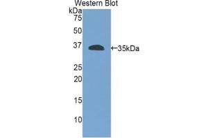 Western blot analysis of the recombinant protein. (Integrin beta 4 antibody  (AA 923-1197))