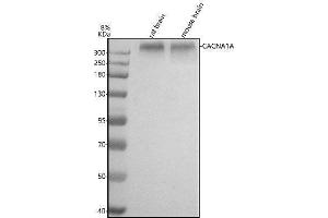 Western blot analysis of CACNA1A using anti-CACNA1A antibody (ABIN7600927).