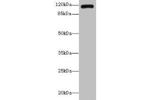 Western blot All lanes: INVS antibody IgG at 14 μg/mL + K562 whole cell lysate Secondary Goat polyclonal to rabbit IgG at 1/10000 dilution Predicted band size: 118, 100, 11 kDa Observed band size: 118 kDa (Inversin antibody  (AA 1-101))