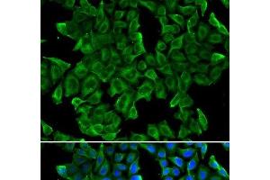 Immunofluorescence analysis of MCF-7 cells using REG3G Polyclonal Antibody (REG3g antibody)