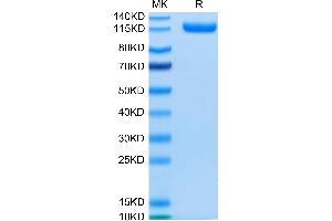 Human CDCP1 on Tris-Bis PAGE under reduced condition. (CDCP1 Protein (AA 30-666) (Fc Tag))