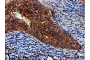 Image no. 6 for anti-Epsin 2 (EPN2) antibody (ABIN1498051) (Epsin 2 antibody)