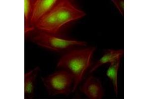 Immunofluorescenitrocellulosee of human HeLa cells stained with Phalloidin-TRITC (Red) for Actin staining and monoclonal anti-human UBE2S antibody (1:500) with Alexa 488 (Green). (UBE2S antibody  (AA 1-222))