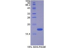 SDS-PAGE (SDS) image for Vasoactive Intestinal Peptide (Vip) (AA 28-159) protein (His tag) (ABIN2122324) (Vip Protein (AA 28-159) (His tag))