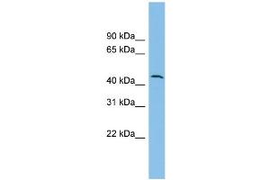 WB Suggested Anti-DPH1 Antibody Titration: 0. (DPH1 antibody  (N-Term))