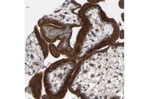 Immunohistochemical staining of human placenta with PTCD1 polyclonal antibody  shows strong cytoplasmic positivity in trophoblastic cells. (PTCD1 antibody)