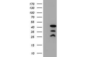 Western Blotting (WB) image for anti-PDZ and LIM Domain 2 (PDLIM2) antibody (ABIN1500127) (PDLIM2 antibody)