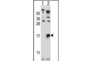 Western blot analysis of GYPB (arrow) using rabbit polyclonal GYPB Antibody (Center) (ABIN657621 and ABIN2846617). (CD235b/GYPB antibody  (AA 22-51))