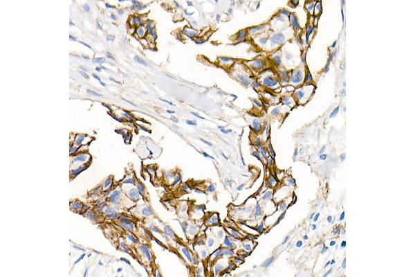 CTNND1 antibody