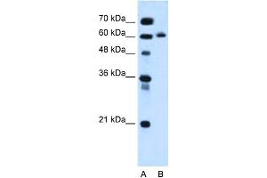 WB Suggested Anti-KIAA1754L Antibody Titration:  0. (ITPRIPL1 antibody  (C-Term))