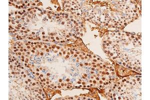 Immunohistochemistry (IHC) image for anti-Jun Proto-Oncogene (JUN) (pThr91) antibody (ABIN6256604)