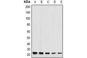 Western blot analysis of GFER expression in MCF7 (A), A375 (B), mouse liver (C), mouse testis (D), rat brain (E) whole cell lysates.