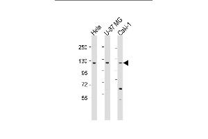 All lanes : Anti-STARD8 Antibody (N-Term) at 1:1000-1:2000 dilution Lane 1: Hela whole cell lysate Lane 2: U-87 MG whole cell lysate Lane 3: Caki-1 whole cell lysate Lysates/proteins at 20 μg per lane. (STARD8 antibody  (AA 220-255))