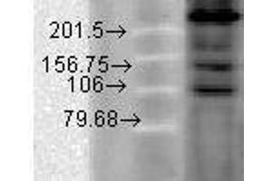 Image no. 3 for anti-Calcium Channel, Voltage-Dependent, L Type, alpha 1C Subunit (CACNA1C) (AA 1507-1733) antibody (ABIN361759)