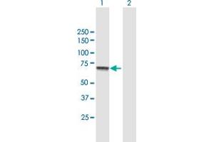 Western Blot analysis of CPT2 expression in transfected 293T cell line by CPT2 MaxPab polyclonal antibody. (CPT2 antibody  (AA 1-658))