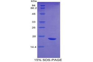 SDS-PAGE (SDS) image for Interleukin 17 (IL17) (AA 25-169) protein (His tag,GST tag) (ABIN1877825)