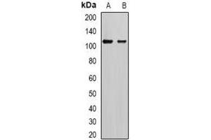 Western blot analysis of AP2-alpha-2 expression in SKOV3 (A), mouse brain (B) whole cell lysates. (AP2A2 antibody)