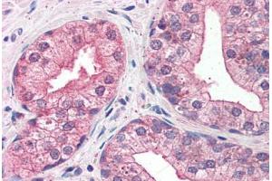 Prostate: Formalin-Fixed, Paraffin-Embedded (FFPE) (LMO4 antibody  (AA 115-127))