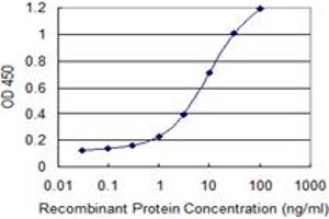 Detection limit for recombinant GST tagged LDOC1 is 0. (LDOC1 antibody  (AA 1-146))