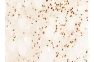 Rat LV-Htt171-82Q (800 ng) PFA 4% HTT Ab, 1/2,000 PBS-BSA 1% - 25 µm. (Huntingtin antibody  (AA 85-200))