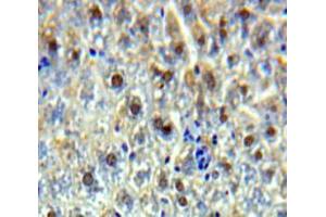 Used in DAB staining on fromalin fixed paraffin-embedded Liver tissue (SSRP1 antibody  (AA 6-246))