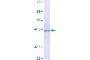 GSTM1 Protein (AA 1-181) (GST tag)