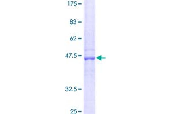 GSTM1 Protein (AA 1-181) (GST tag)