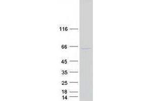 Western Blotting (WB) image for Doublecortin Domain Containing 2 (DCDC2) protein (Myc-DYKDDDDK Tag) (ABIN2719244)