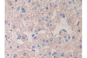 Detection of CRKL in Human Liver Tissue using Polyclonal Antibody to Crk Like Protein (CRKL) (CrkL antibody  (AA 1-303))