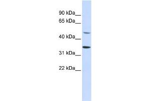 WB Suggested Anti-ZNF398 Antibody Titration:  0. (ZNF398 antibody  (Middle Region))
