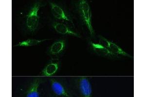 Immunofluorescence analysis of U-2 OS cells using BRK1 Polyclonal Antibody at dilution of 1:100. (BRK1 antibody)