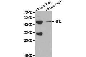 Western blot analysis of extracts of mouse brain and mouse heart tissues, using HFE antibody. (HFE antibody)