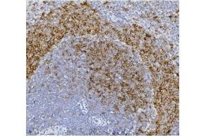 IHC analysis of CD79b using anti-CD79b antibody (ABIN7601115). (CD79b antibody  (AA 29-229))