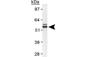 Western blot analysis of TERF2 in HeLa nuclear extract using TERF2 polyclonal antibody . (TRF2 antibody)