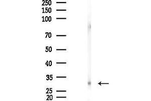 anti-PYD and CARD Domain Containing (PYCARD) (N-Term) antibody