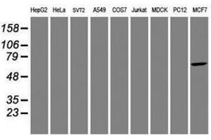 Image no. 5 for anti-Aryl Hydrocarbon Receptor Interacting Protein-Like 1 (AIPL1) antibody (ABIN1496508) (AIPL1 antibody)