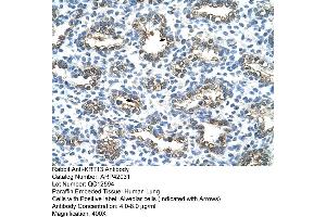 Rabbit Anti-KRT13 Antibody  Paraffin Embedded Tissue: Human Lung Cellular Data: Alveolar cells Antibody Concentration: 4. (Cytokeratin 13 antibody  (C-Term))
