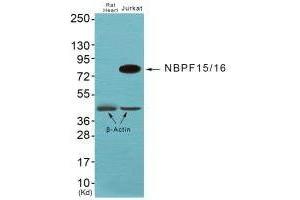 Western blot analysis of extracts from JK cells, using NBPF1/9/10/12/14/15/16/20 antibody. (NBPF12/NBPF1/NBPF1/NBPF9 antibody)