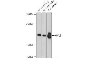 Western blot analysis of extracts of various cell lines using MYL9 Polyclonal Antibody at dilution of 1:1000. (MYL9 antibody)