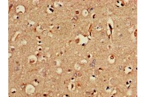 SORCS2 antibody  (AA 712-786)