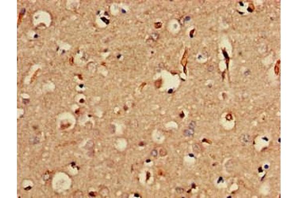 SORCS2 antibody  (AA 712-786)