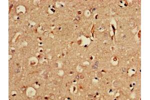 Immunohistochemistry of paraffin-embedded human brain tissue using ABIN7175662 at dilution of 1:100 (SORCS2 antibody  (AA 712-786))