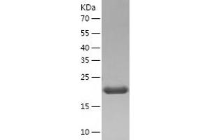 Western Blotting (WB) image for GM2 Ganglioside Activator (GM2A) (AA 26-193) protein (His tag) (ABIN7285520) (GM2A Protein (AA 26-193) (His tag))