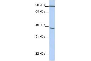 WB Suggested Anti-POPDC3 Antibody Titration:  0. (POPDC3 antibody  (C-Term))