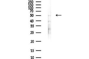 anti-Ethanolamine Kinase 1 (ETNK1) antibody
