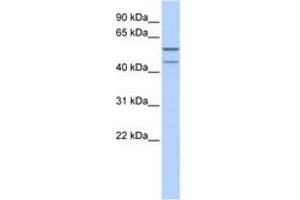 Image no. 1 for anti-Zinc Finger Protein 474 (ZNF474) (AA 35-84) antibody (ABIN6742256) (ZNF474 antibody  (AA 35-84))