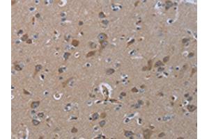 The image on the left is immunohistochemistry of paraffin-embedded Human brain tissue using ABIN7129900(INSIG2 Antibody) at dilution 1/30, on the right is treated with fusion protein. (INSIG2 antibody)